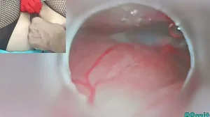 Japanese Insemination with Cum into Uterus and Endoscope Camera by Cervix to watch inside womb Uncensored